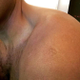 Don Lemon’s scar
Twitter